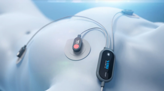 可穿戴設備電池大戰：中、日、韓誰領風騷？